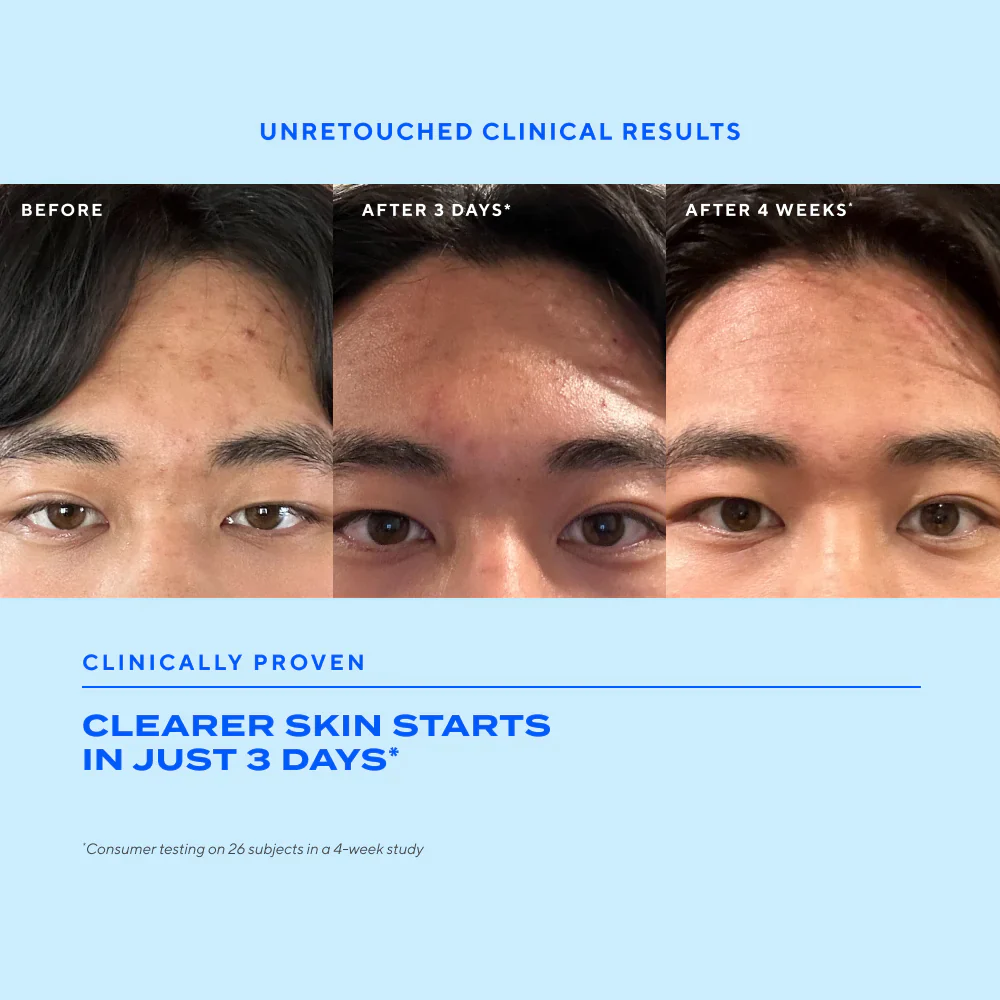 Blemish Clearing Duo - Image 3