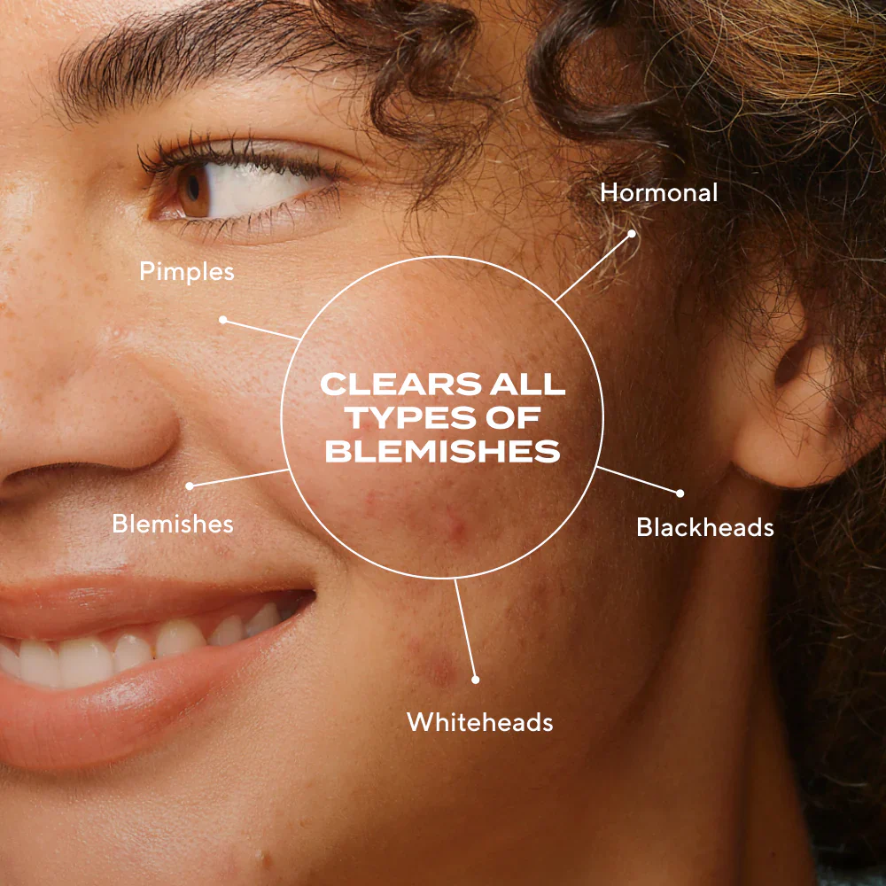 Blemish Clearing Duo - Image 4
