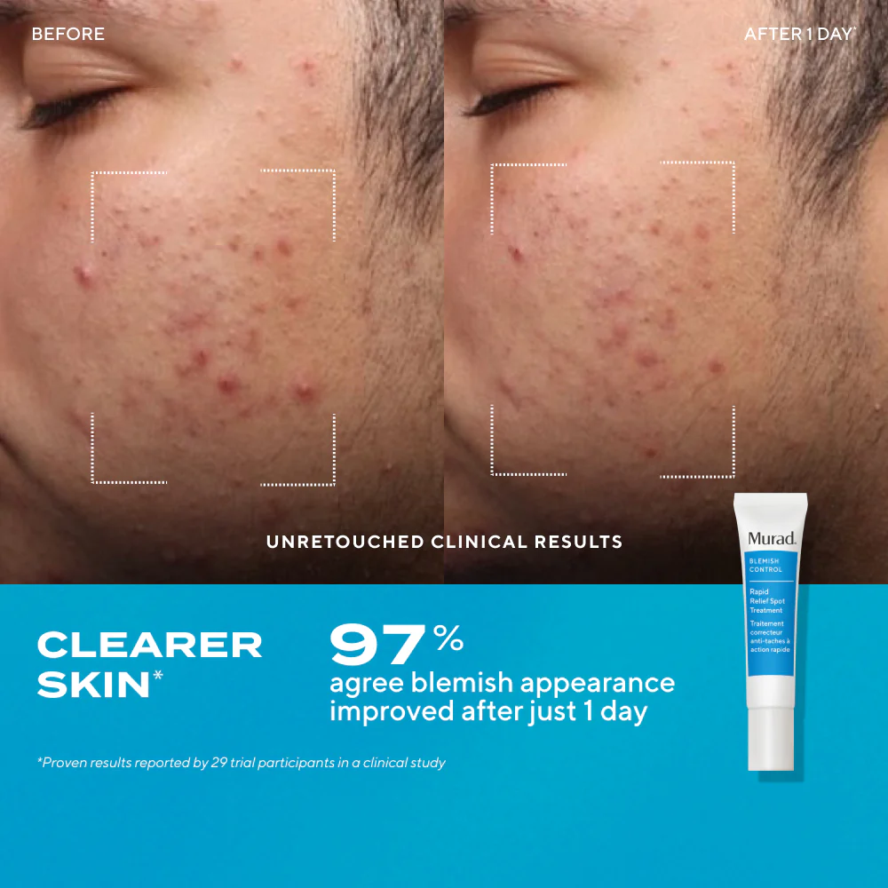 Blemish Control Kit - Image 4