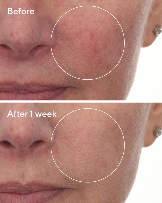 Cellular Hydration Barrier Repair Serum - Image 4