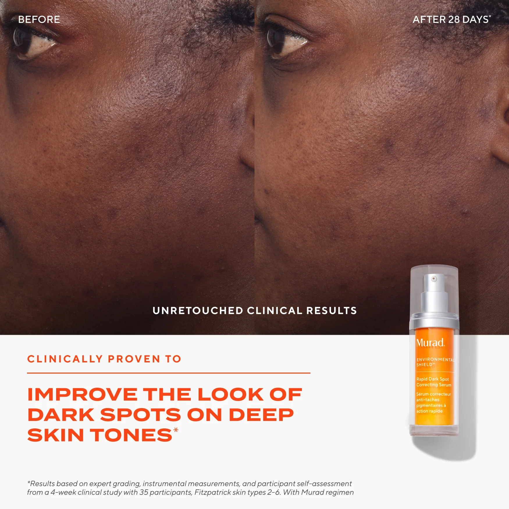 Dark Spot Clearing Duo - Image 6
