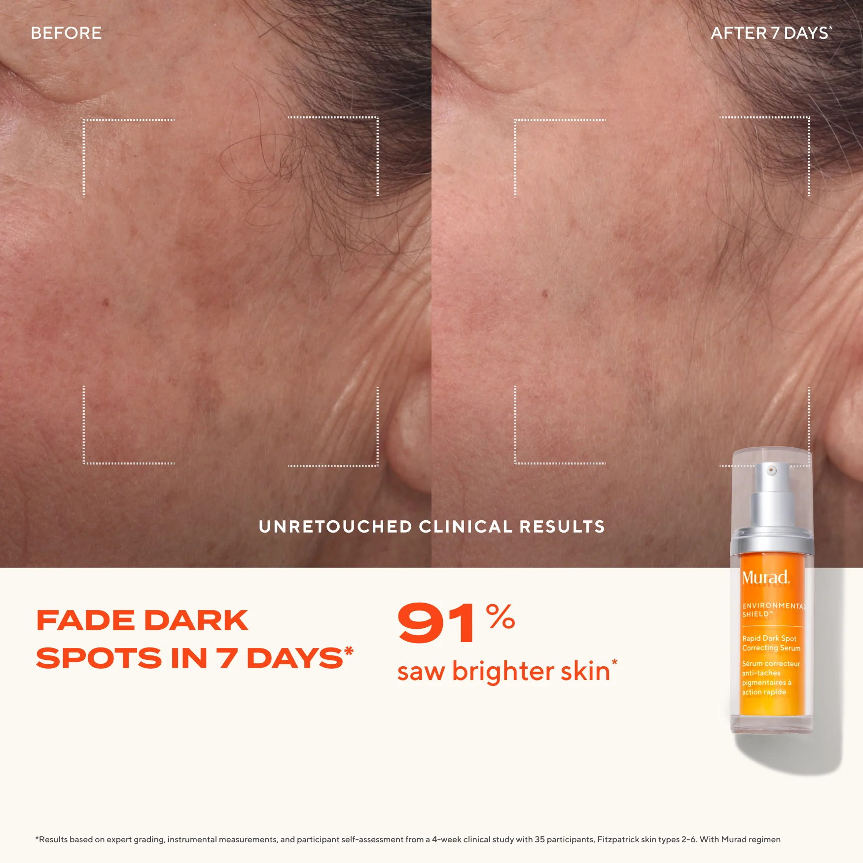 Rapid Dark Spot Correcting Serum - Image 4
