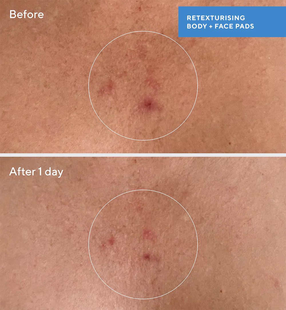 Retexturising Body + Face Pads - Image 3