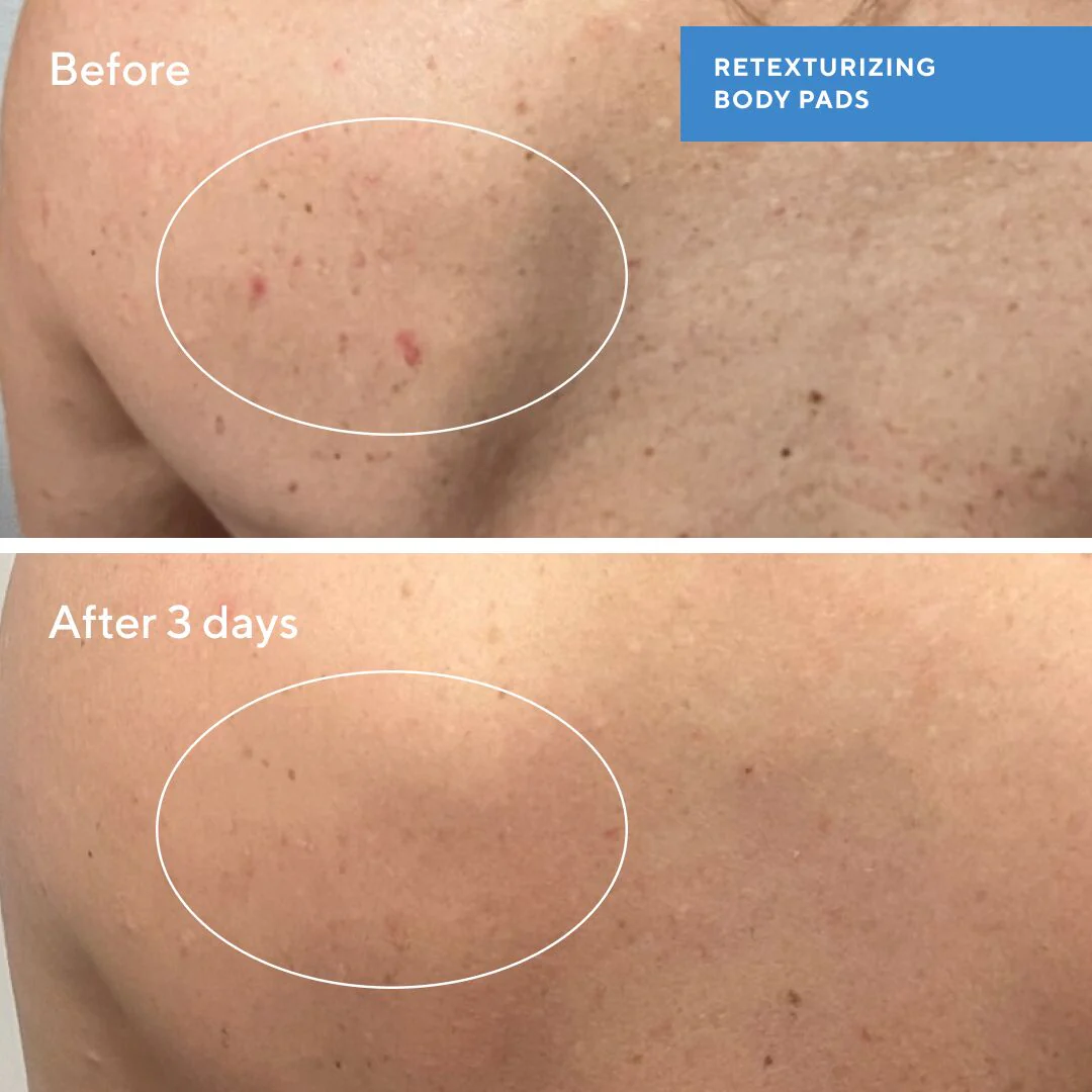 Retexturising Body + Face Pads - Image 4