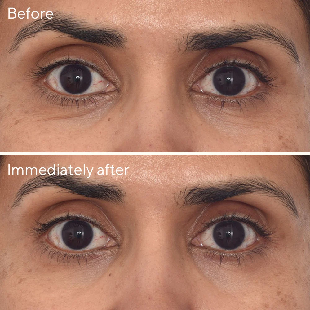 Retinol Youth Renewal Eye Mask - Single Pack - Image 5