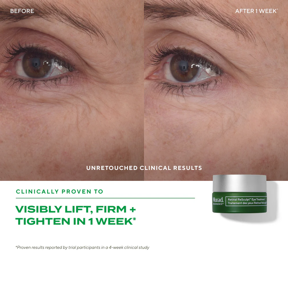 The Retinal Face Heroes - Image 8